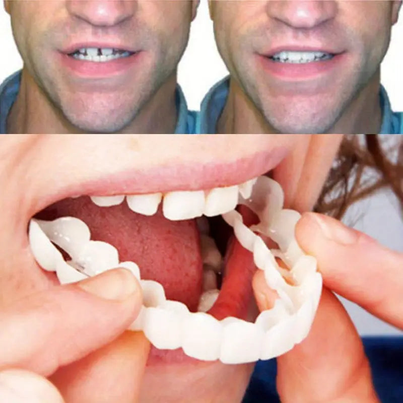 Pair of Snap-On Teeth Covers – Natural Look, Instant Smile Upgrade