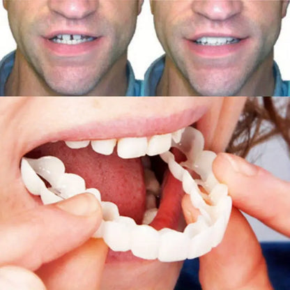 Pair of Snap-On Teeth Covers – Natural Look, Instant Smile Upgrade
