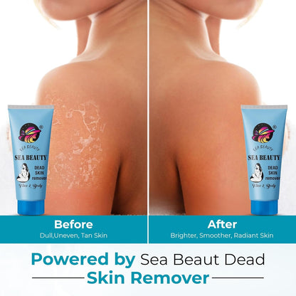 Dead Skin Remover Exfoliate gel for smooth and soft get Tan Free Skin Pack of 1 100ml